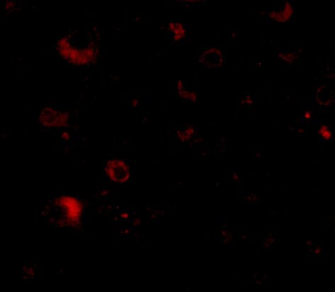 RIMS2 Antibody - BSA Free
