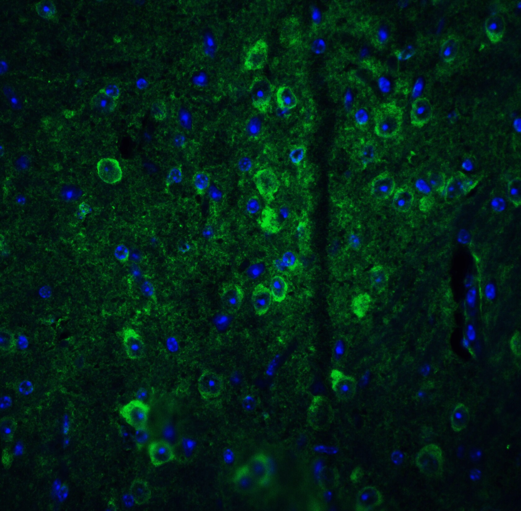 GPAM Antibody - BSA Free
