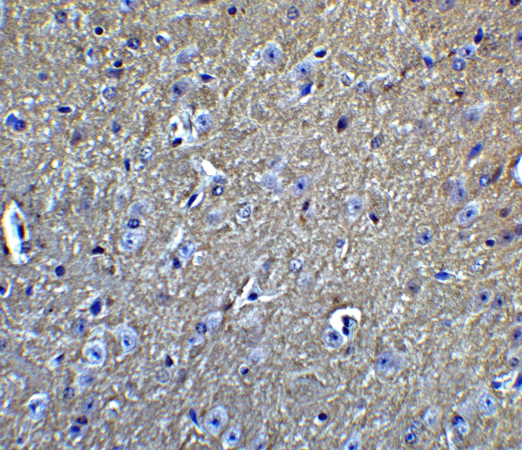 APP Antibody - BSA Free