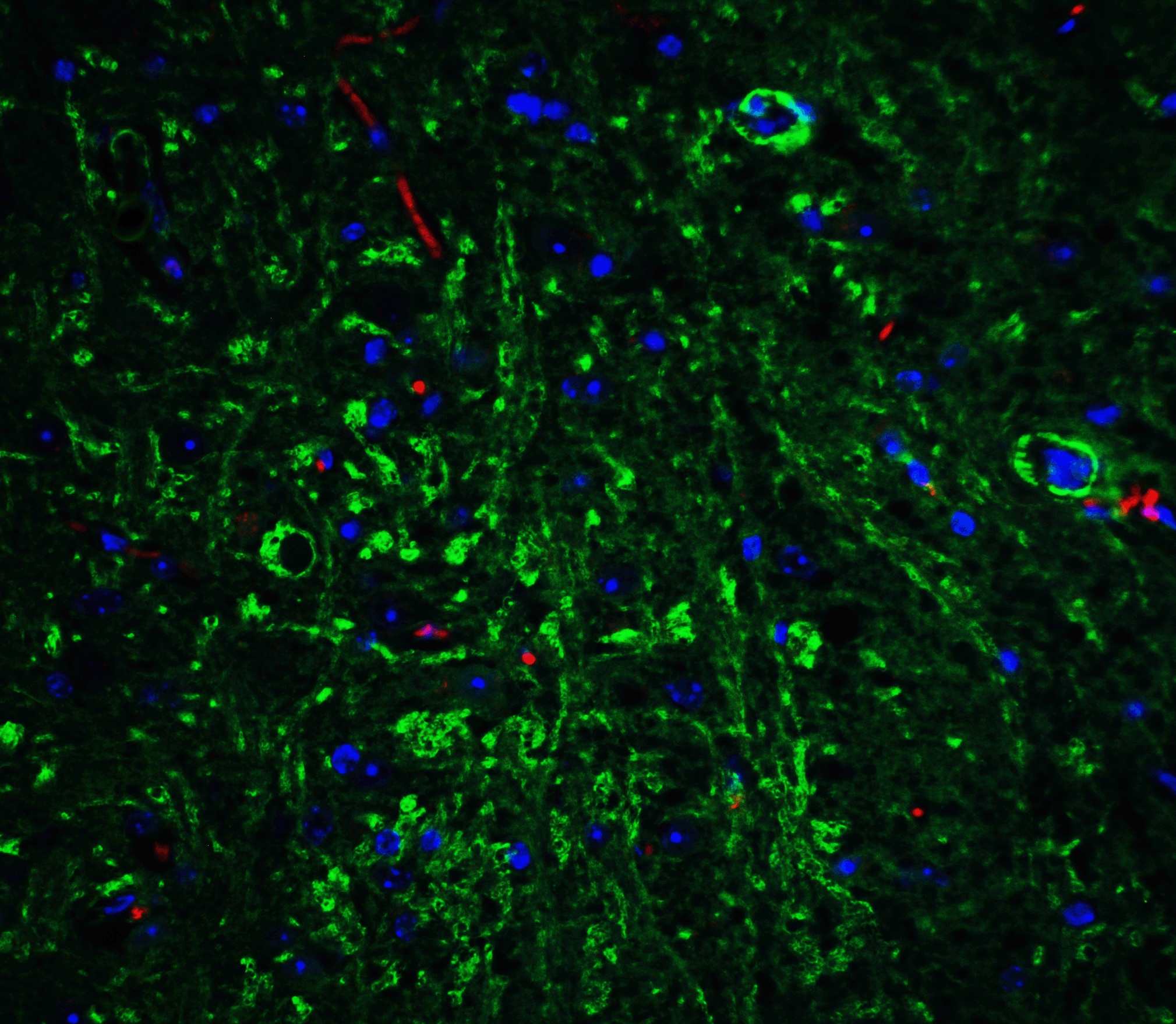 APP Antibody - BSA Free