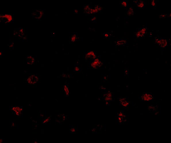 GKAP/DLGAP1 Antibody - BSA Free