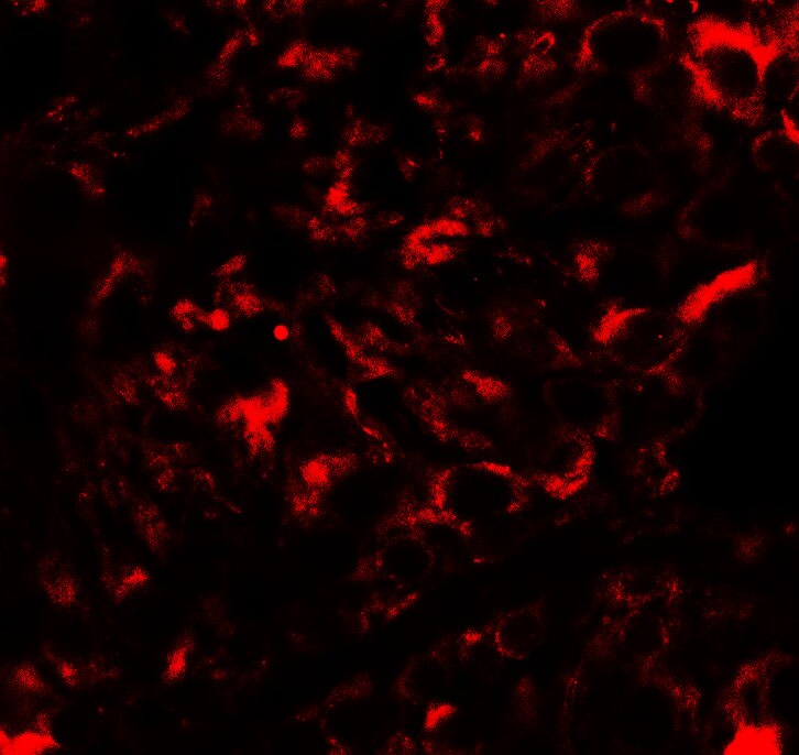 Nanos2 Antibody - BSA Free