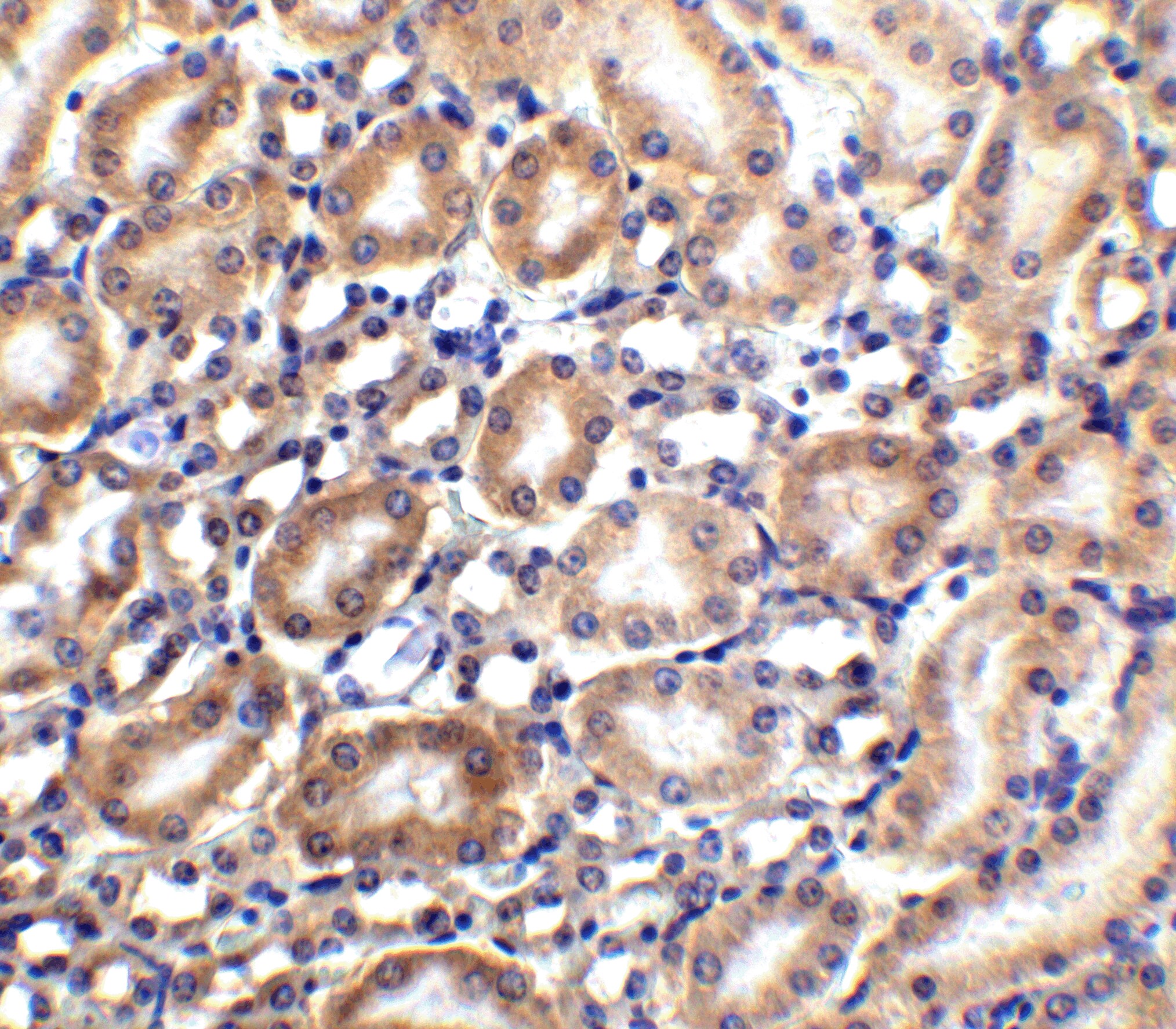 SLC22A17 Antibody - BSA Free