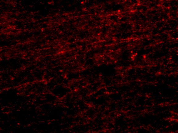 CLIP170 Antibody - BSA Free