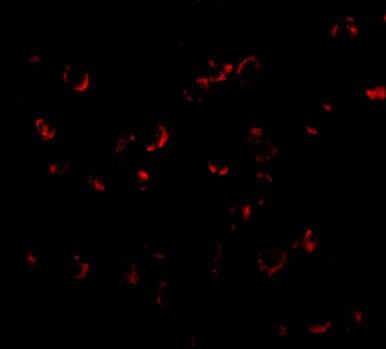 BICD1 Antibody - BSA Free