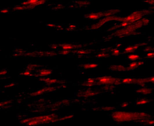 ASAH1 Antibody - BSA Free