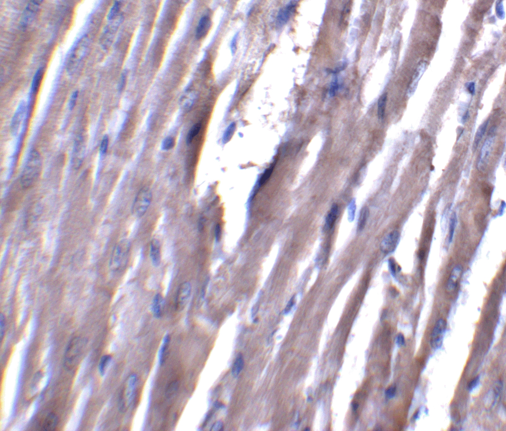 ASAH1 Antibody - BSA Free