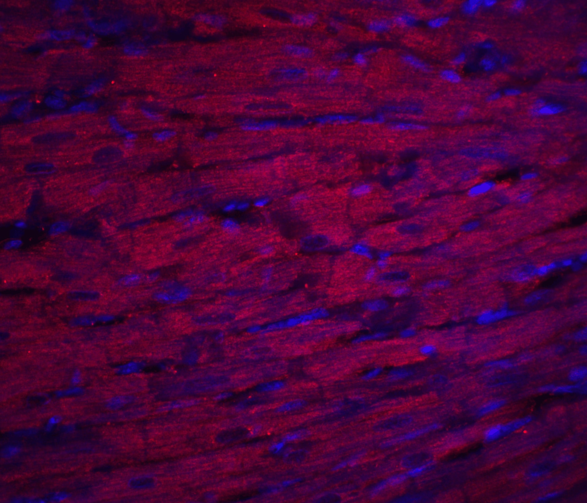 ASAH1 Antibody - BSA Free