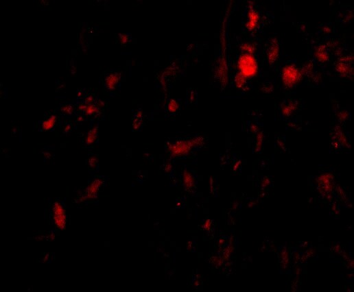 Calpain 6 Antibody - BSA Free