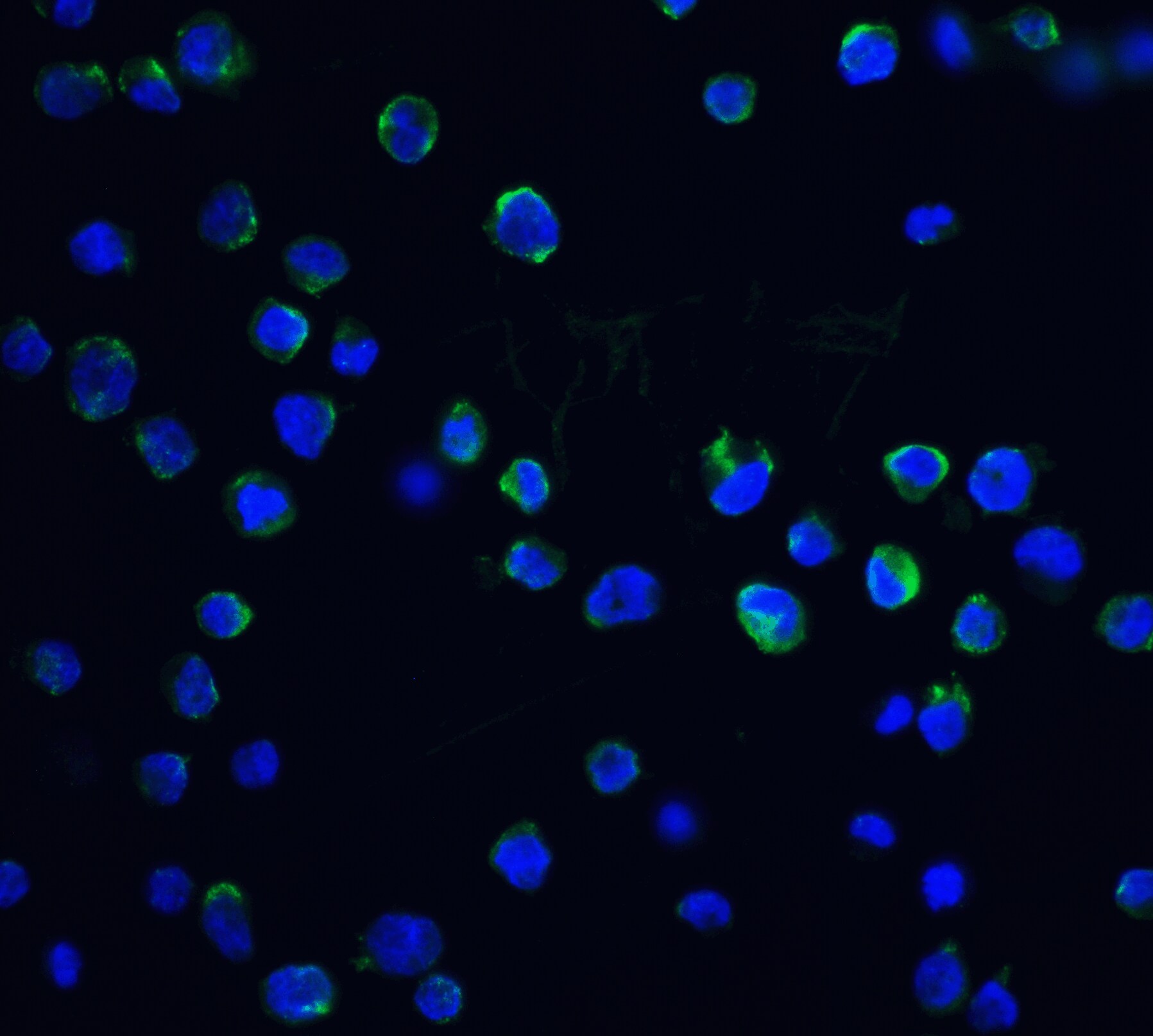 DFF40/CAD Antibody - BSA Free