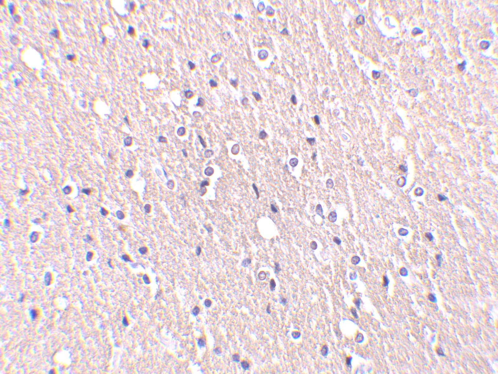 CIDEA Antibody - BSA Free