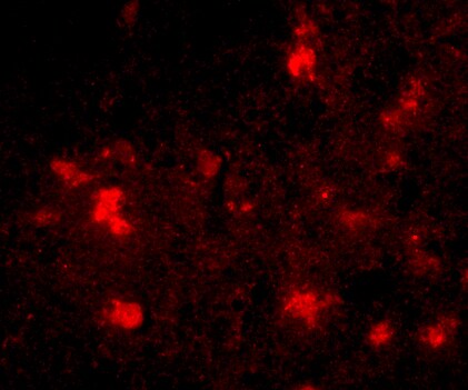 Dact2 Antibody - BSA Free