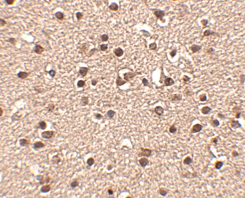Dact2 Antibody - BSA Free