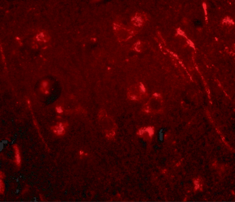 AIPL1 Antibody - BSA Free