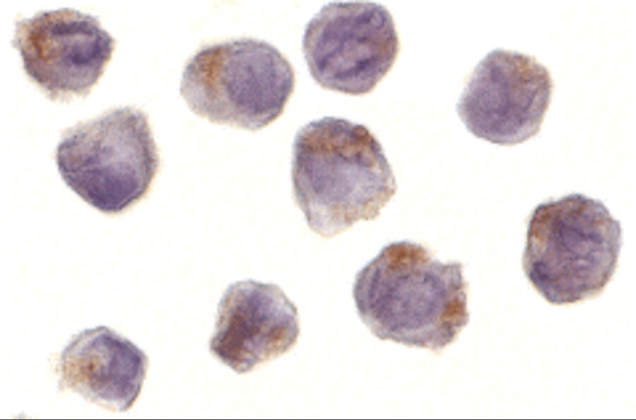 RIPK2 Antibody - BSA Free