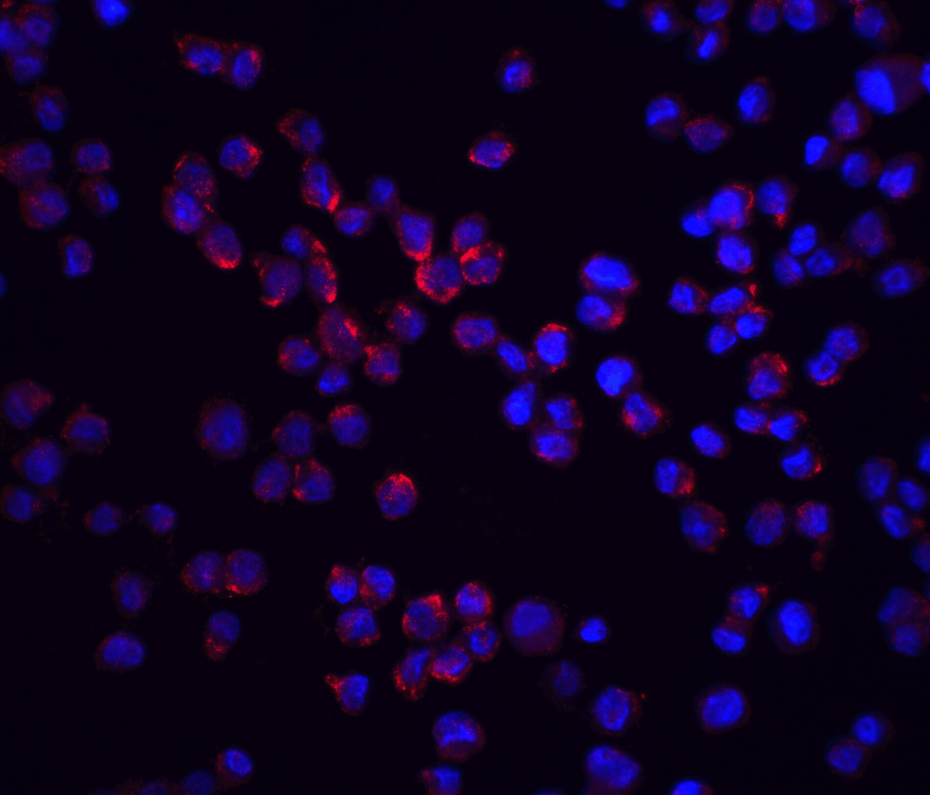 RIPK2 Antibody - BSA Free