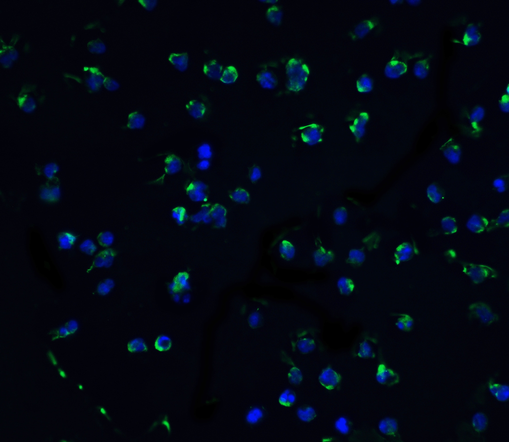 DAPK3/ZIPK Antibody - BSA Free