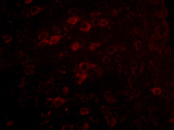 LASS6 Antibody - BSA Free