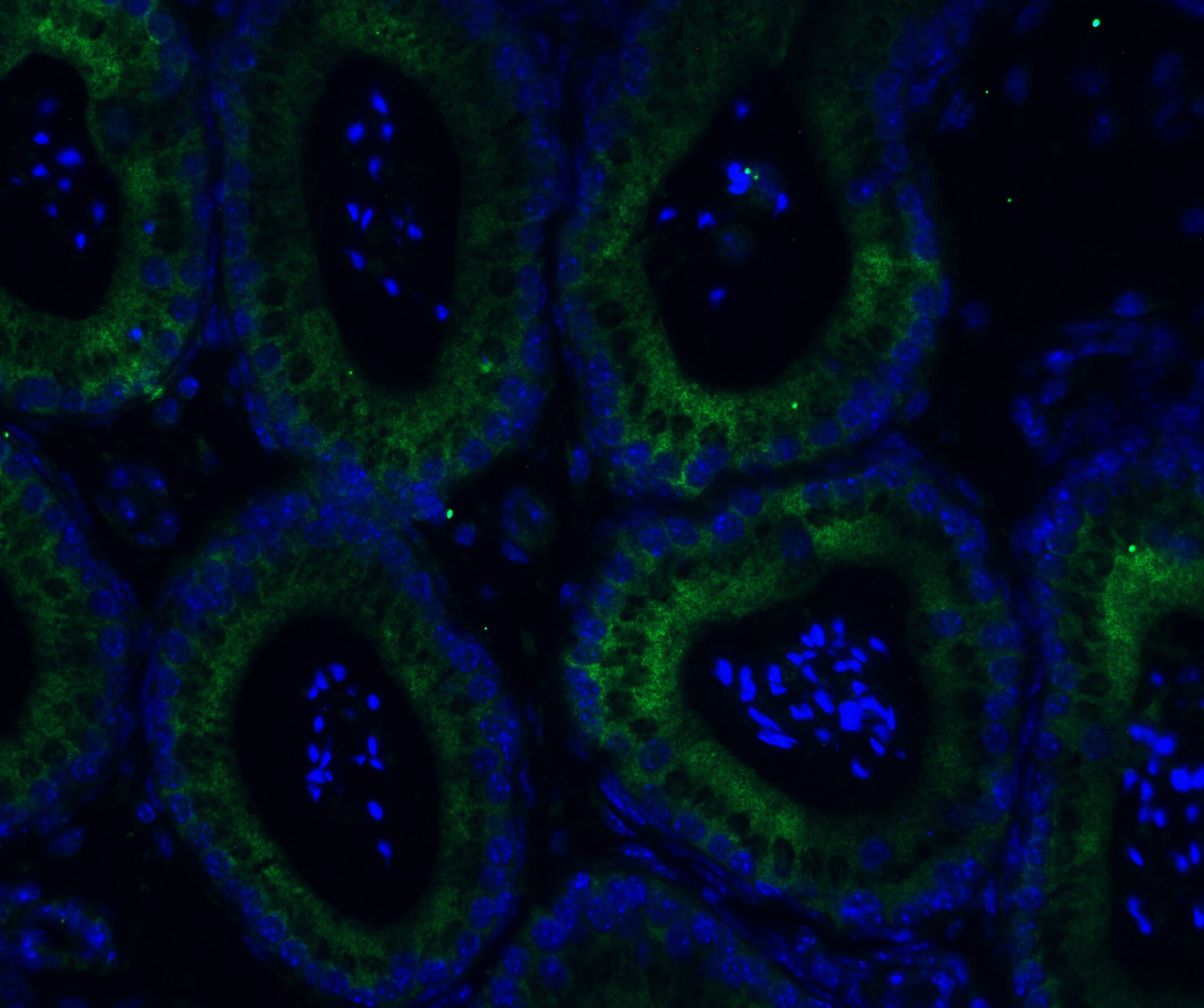 ADAM10 Antibody - BSA Free