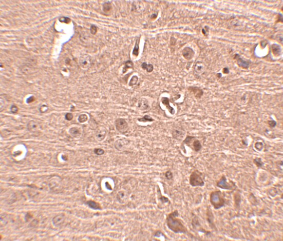 GLE1 Antibody - BSA Free