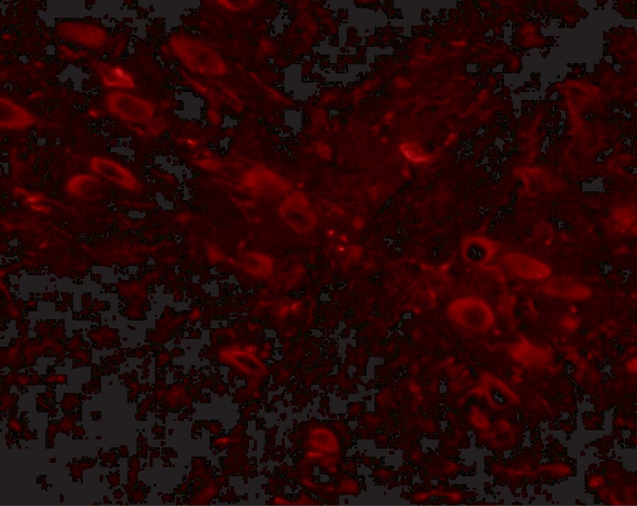 GLE1 Antibody - BSA Free