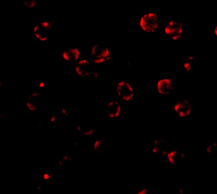 RNASEH2A Antibody - BSA Free