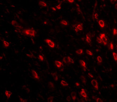 TTBK1 Antibody - BSA Free