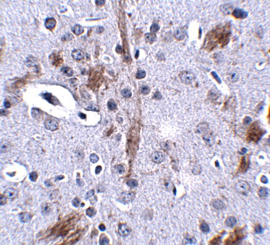 TTBK1 Antibody - BSA Free