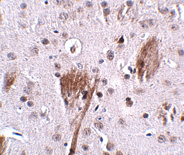 SPG11 Antibody - BSA Free