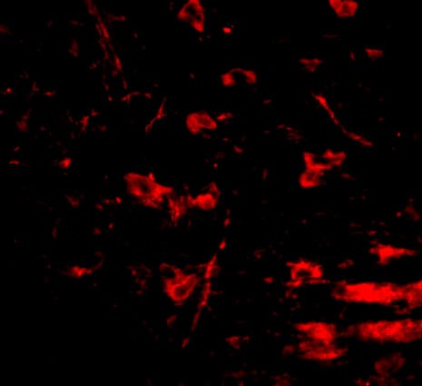RCAN2 Antibody - BSA Free