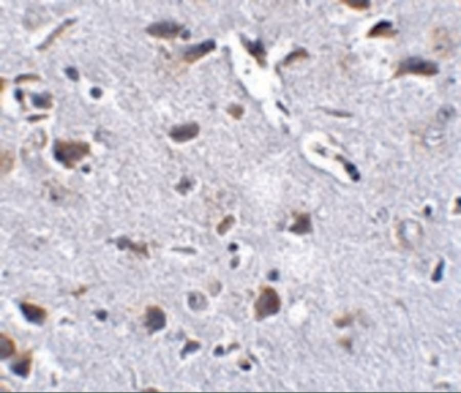 RCAN2 Antibody - BSA Free