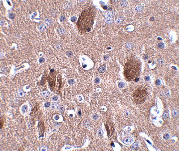 CDIP Antibody - BSA Free
