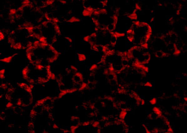 MTCH2 Antibody - BSA Free