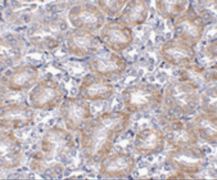 MTCH2 Antibody - BSA Free