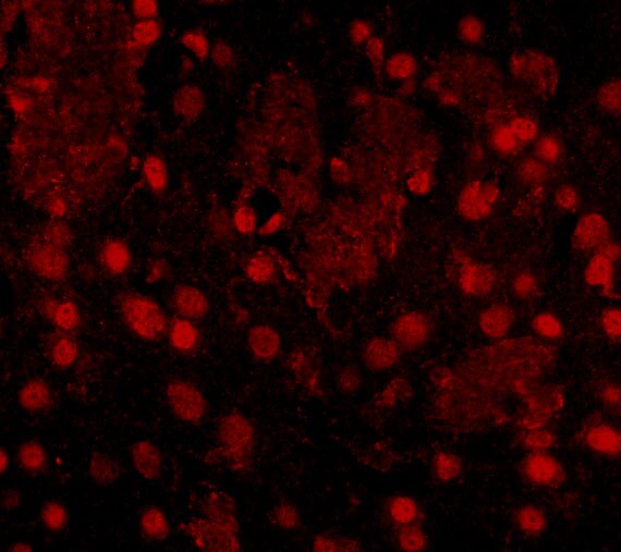 FTO Antibody - BSA Free
