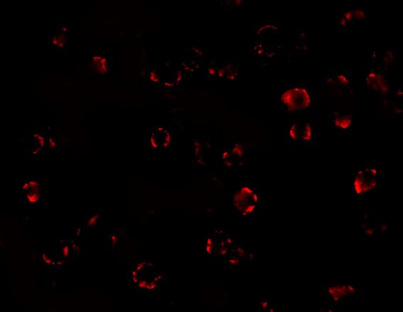 MATN3 Antibody - BSA Free