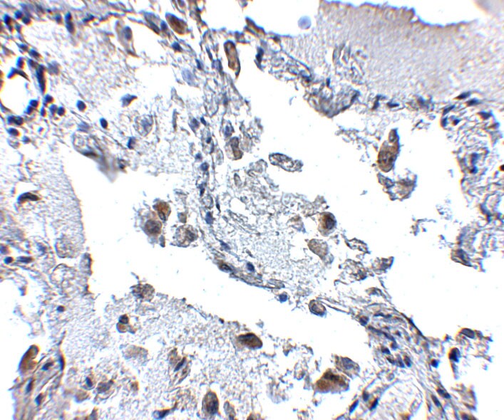 SH3BP4 Antibody - BSA Free