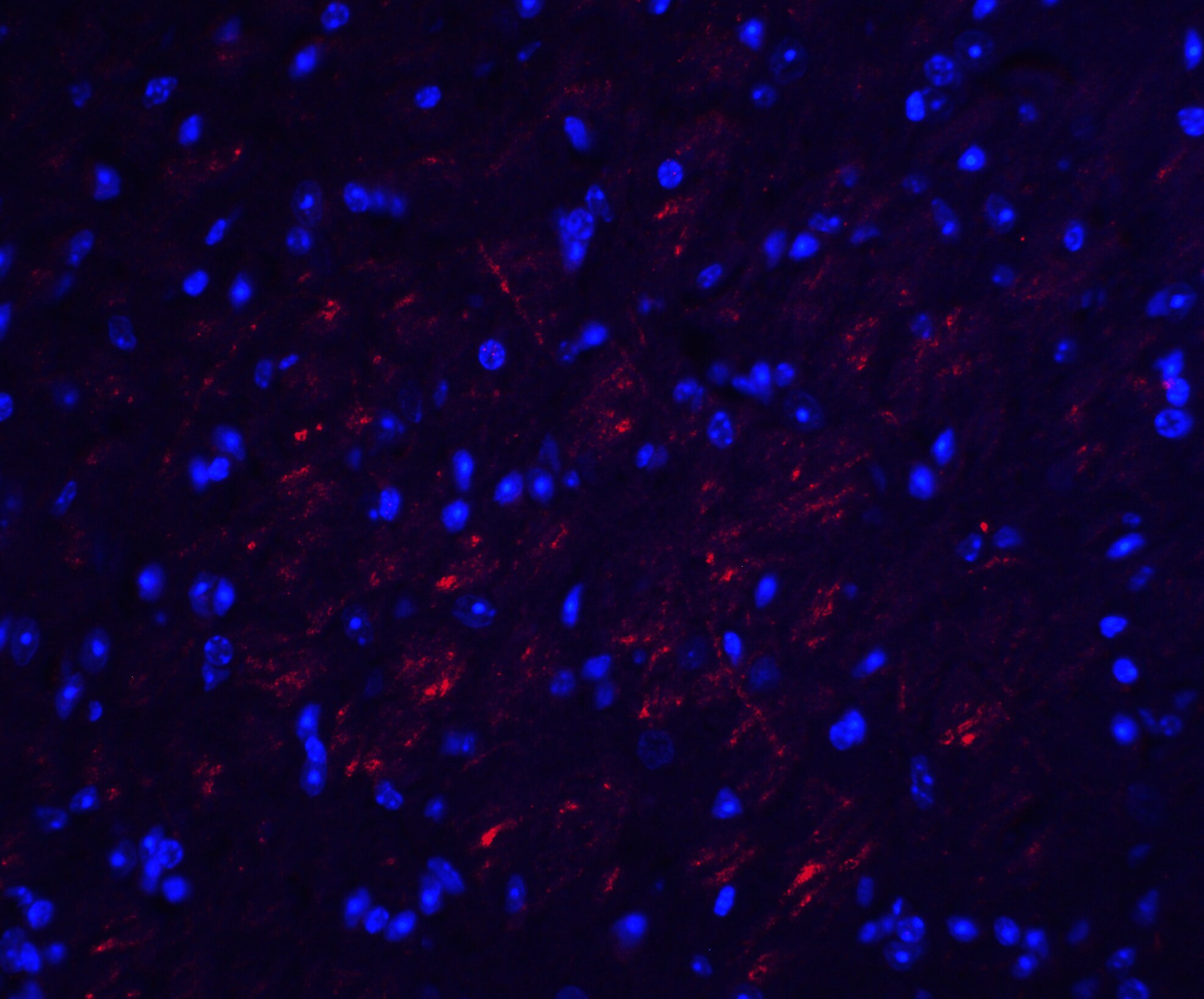 Occludin Antibody - BSA Free