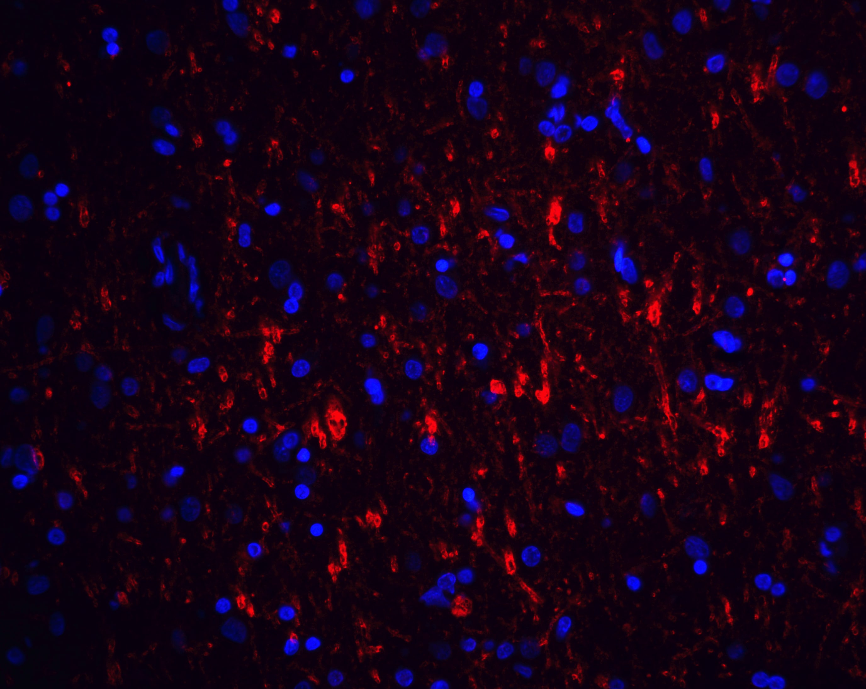 GFR alpha-1/GDNF R alpha-1 Antibody - BSA Free