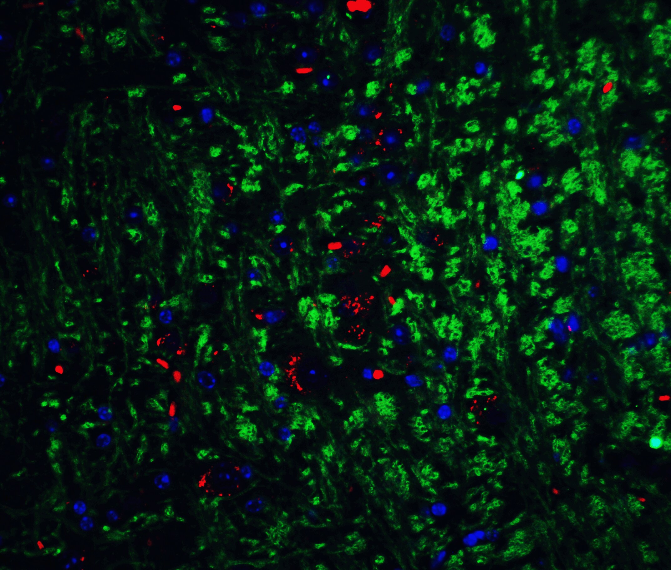 Neurturin Antibody - BSA Free