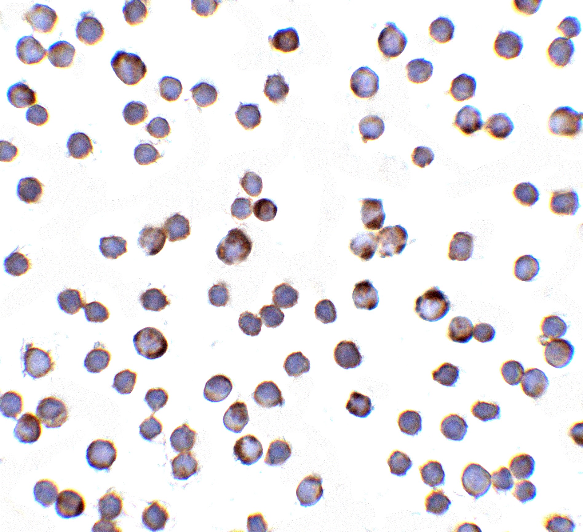 RAIDD/CRADD Antibody - BSA Free