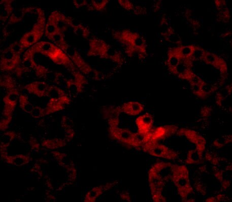 ANKRD54 Antibody - BSA Free