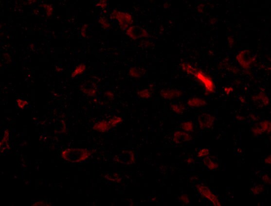 Polypeptide GalNac Transferase 10/GALNT10 Antibody - BSA Free