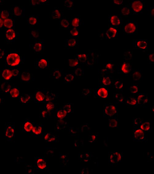 RAIDD/CRADD Antibody - BSA Free