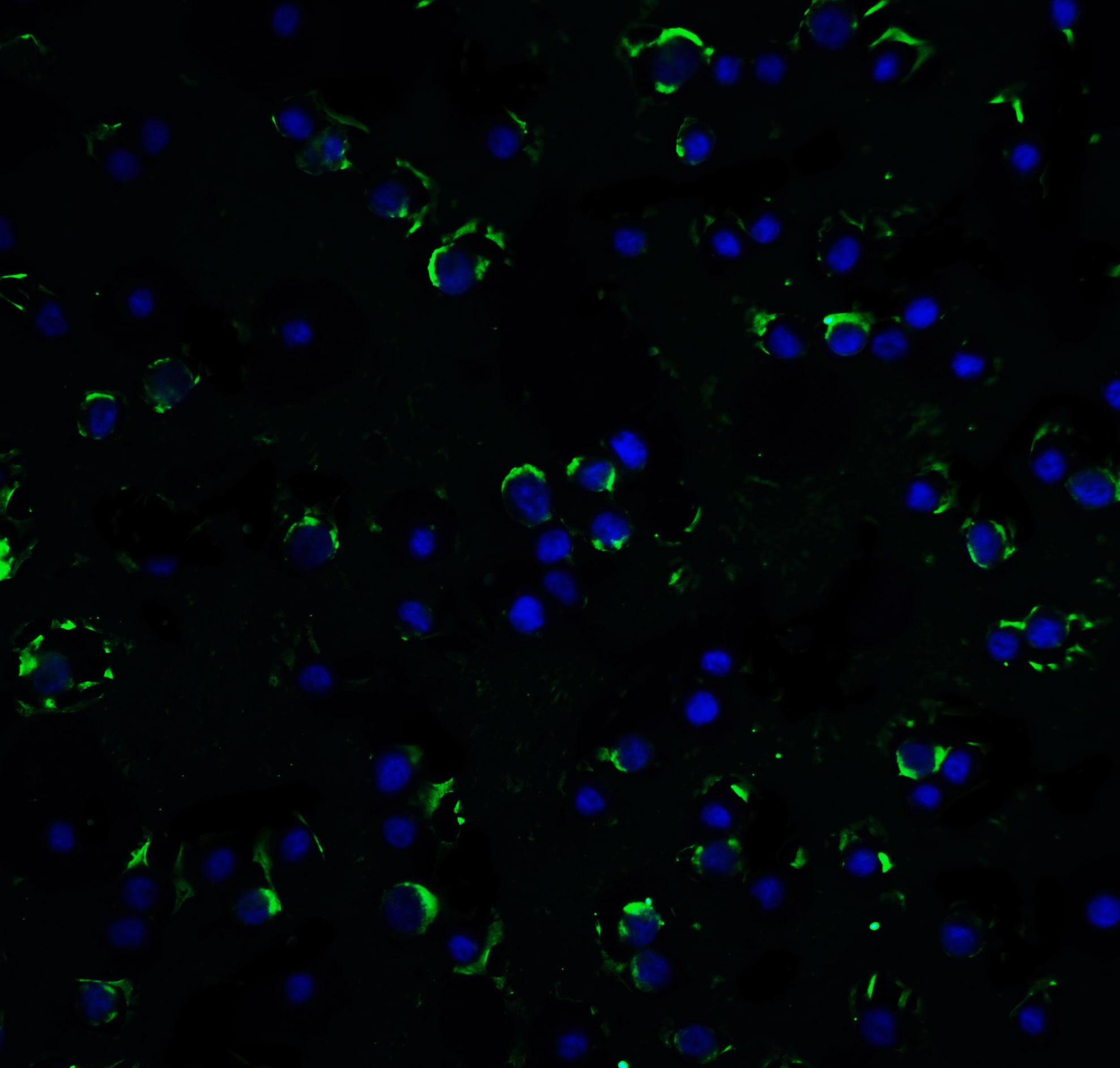 RAIDD/CRADD Antibody - BSA Free