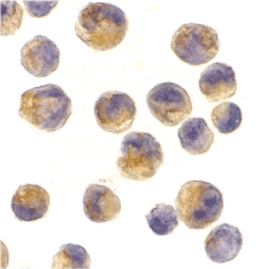 DOK1 Antibody - BSA Free