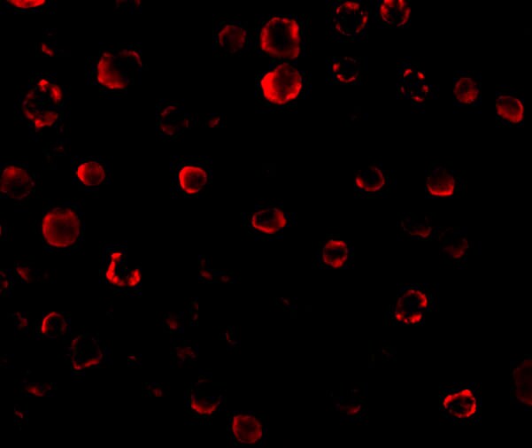 IRAK1 Antibody - BSA Free