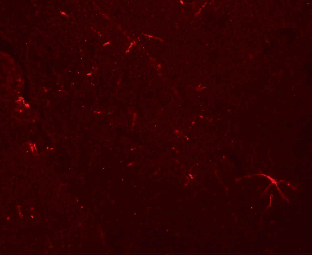 CLP24/TMEM204 Antibody - BSA Free