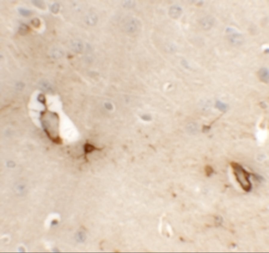 CLP24/TMEM204 Antibody - BSA Free