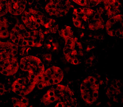JMJD8 Antibody - BSA Free
